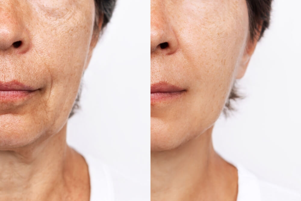 Timberblue Peptide+ Hyaluronic Acid Serum