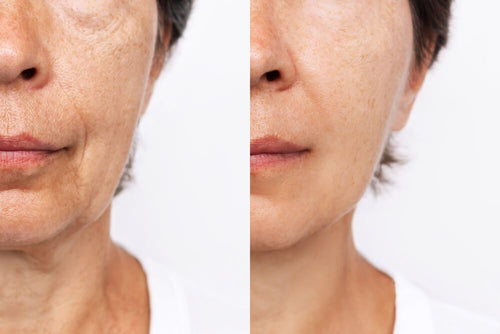 Timberblue Peptide+ Hyaluronic Acid Serum